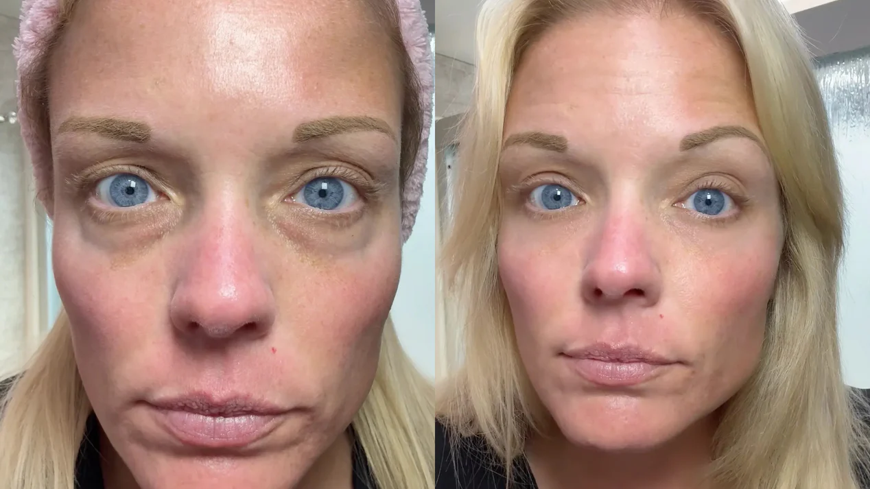 Before and after